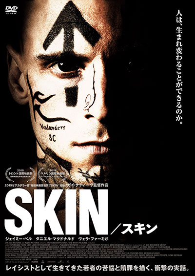 SKIN/スキン